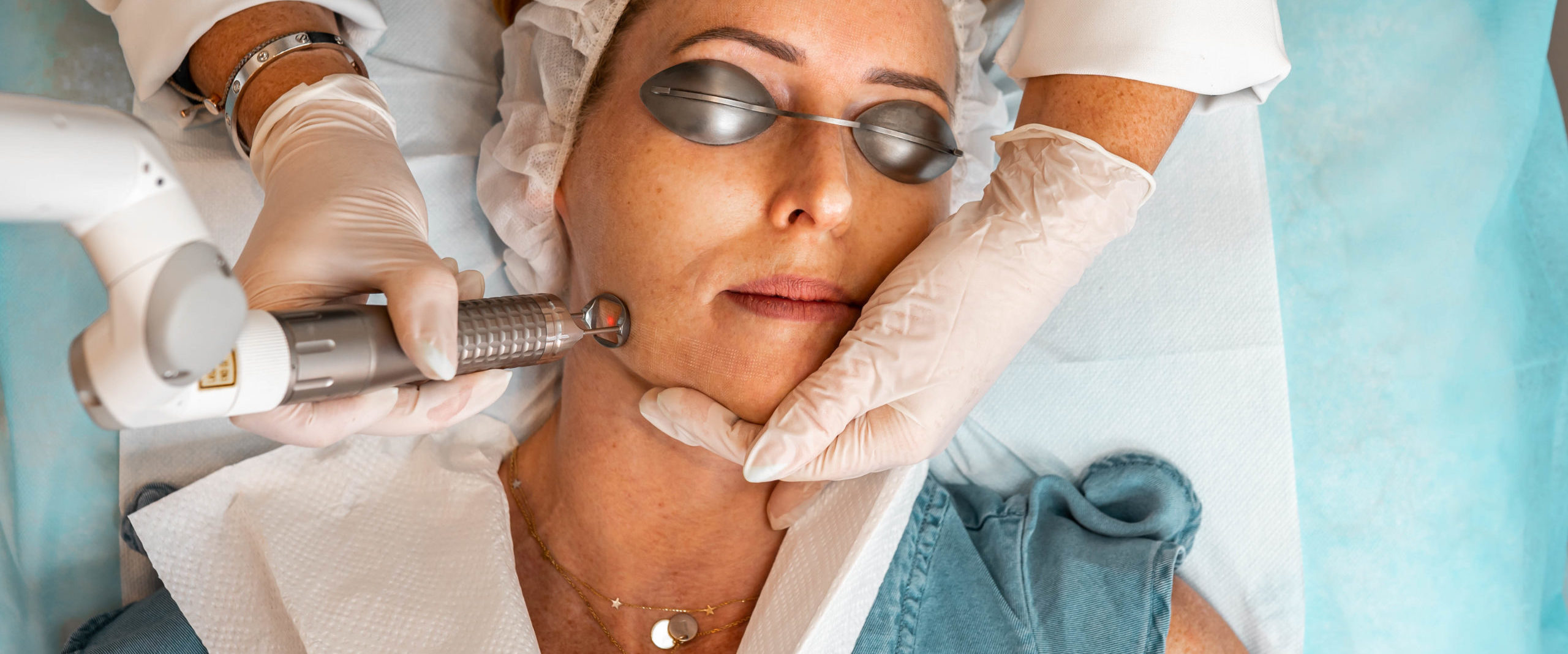 Which Laser Is Best For Melasma?